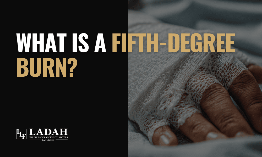 What is a Fifth-Degree Burn - LLF